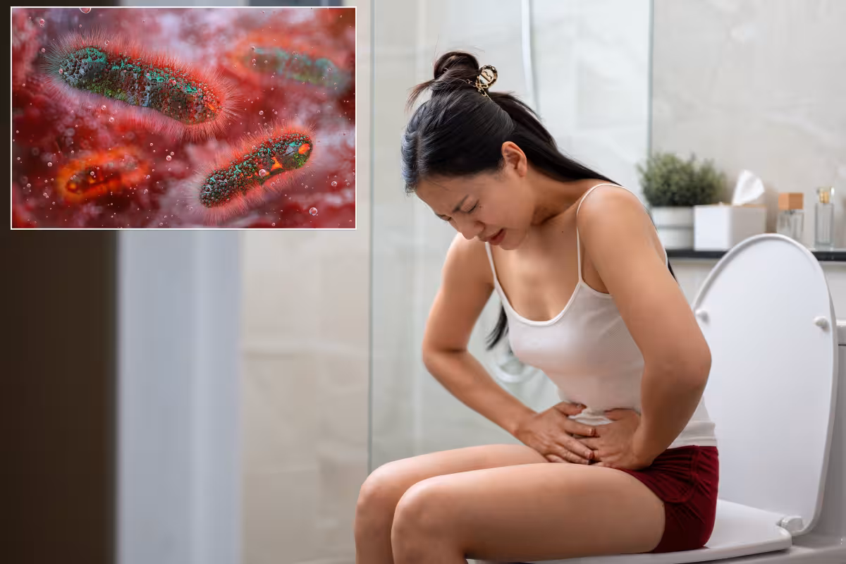 Drug Resistant Shigella Cases Rose Sharply in 2023, CDC Says