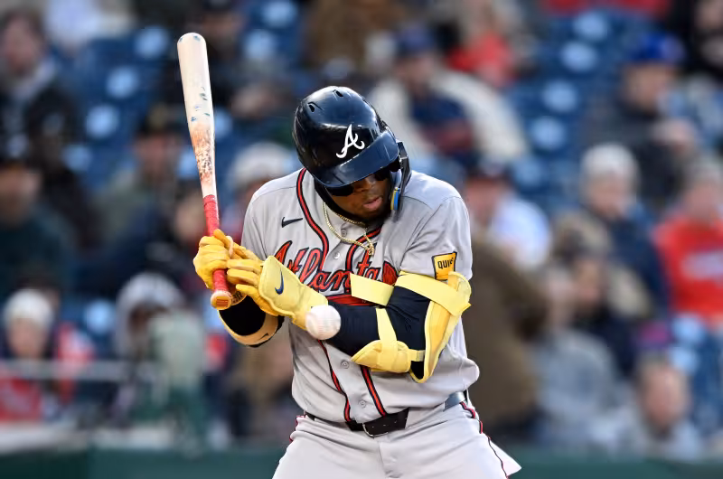 Ronald Acuńa, Jr. leaves game after being hit by pitch