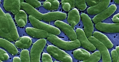 Vibrio Vulnificus New York Waters: Scientist Warns of Rising Risk